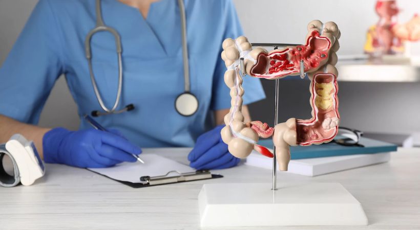 Marcos Juárez lanza una campaña gratuita de prevención del cáncer de colon